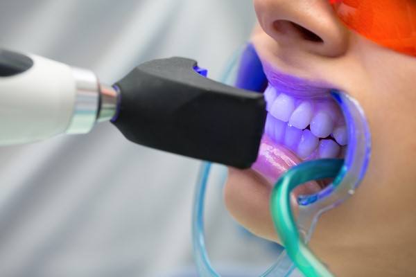 أهمية زراعة الأسنان بالليزر