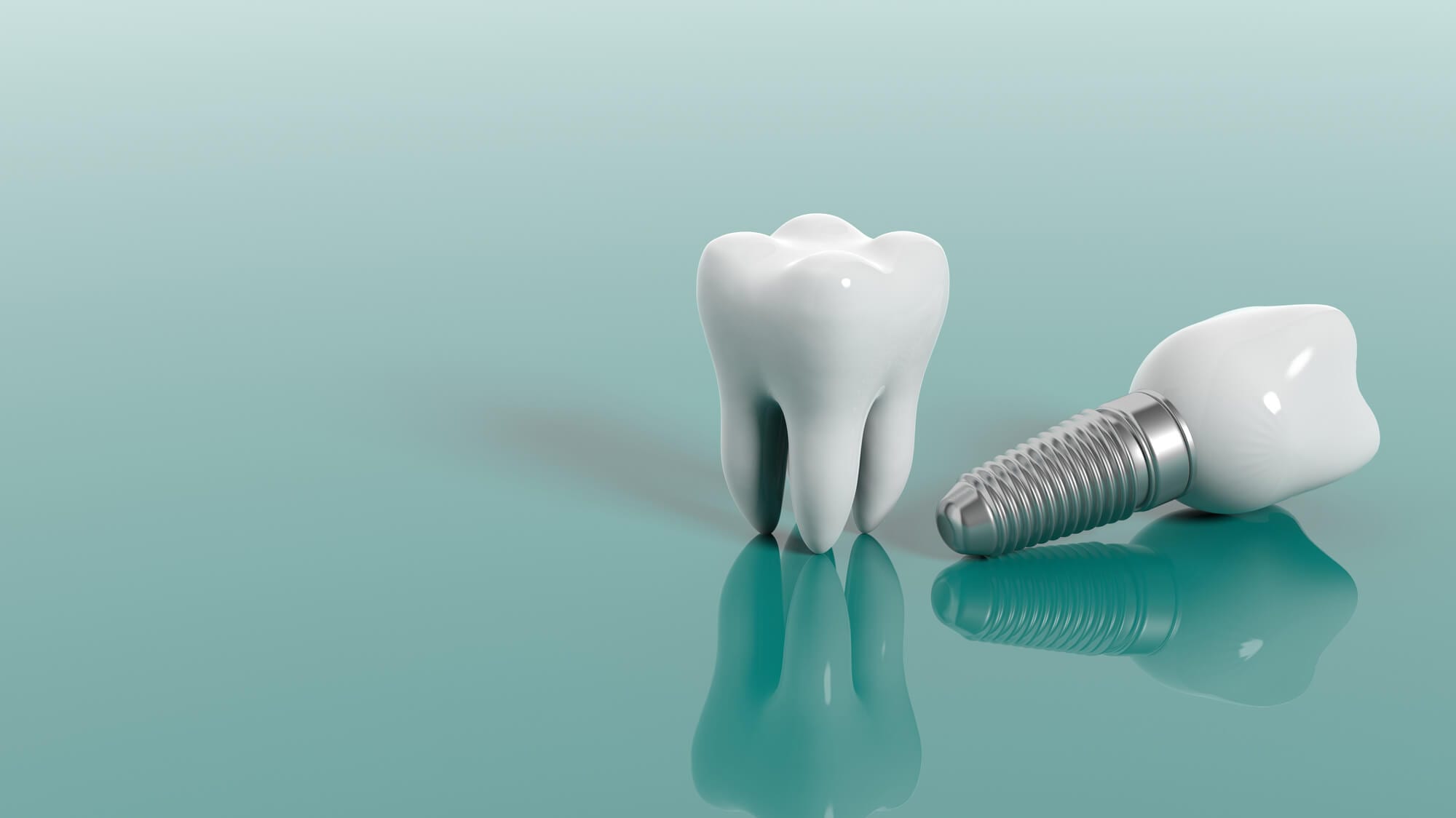ما هي العوامل التي تؤثر على تكلفة زراعة الأسنان؟