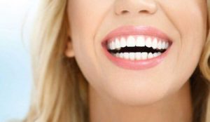 تعرف على آخر تقنيات تجميل الأسنان وما هي الحالات التي تكون بحاجة لتجميل الأسنان؟