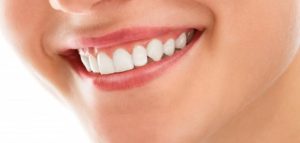 تعرف معنا على احدث تقنيات تجميل الاسنان وما هي أنواعها المختلفة؟