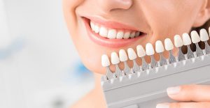 تعرف على افضل طريقة لتجميل الاسنان وما هي أفضل التقنيات لتطبيق ذلك؟