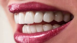 معلومات عن تجميل الاسنان بدون نحت ومتى يتوجب على المرأ تغيير هذه العدسات؟