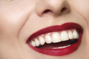 أضرار العدسات اللاصقة للأسنان