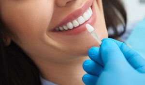 أنواع عدسات الأسنان وافضلها