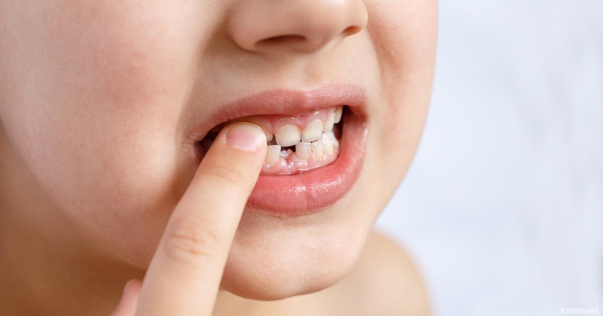 تبديل اسنان الاطفال وطريقة التعامل مع طفلك خلال تلك الفترة!
