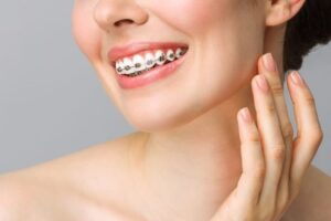 أنواع تقويم الأسنان بالصور واسعارها وأفضل العيادات في مصر