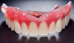 أضرار تركيبات الأسنان المتحركة واسعار طقم الأسنان المتحرك