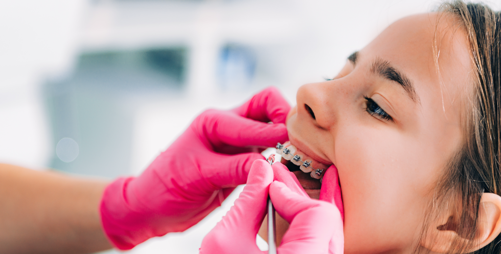 ما هي أضرار تقويم الأسنان؟