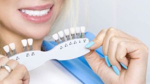 تبييض الاسنان بالعدسات وكم سعر عدسات الاسنان في مصر؟