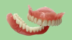 ما هي تركيبة اسنان متحركة تجميلية؟ وكم سعرها؟