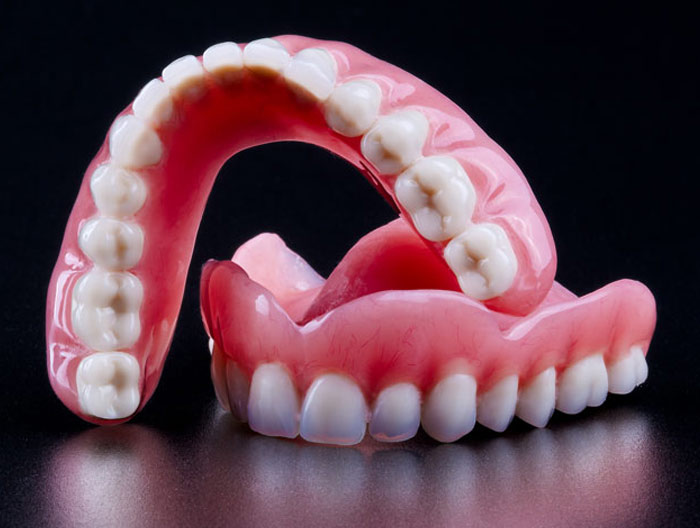 طقم اسنان تجميلي وما هو متوسط أسعار طقم الاسنان؟