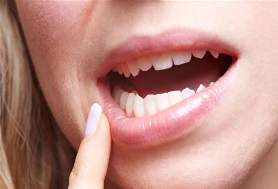 علاج بروز الأسنان