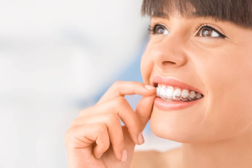 مميزات التقويم الشفاف للأسنان