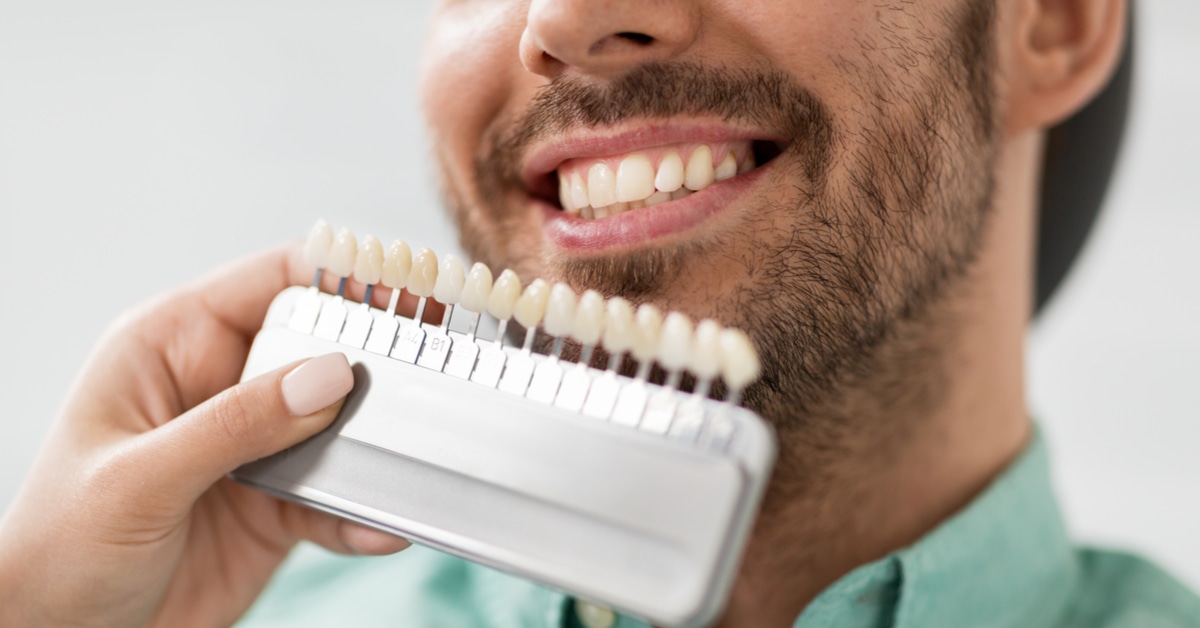 ايه هي أهم مميزات عدسة الأسنان؟