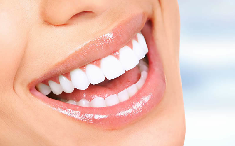 مميزات تركيبات الأسنان