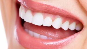 تعرف أكثر على عروض تجميل الاسنان وما هي افضل العيادات في مصر؟