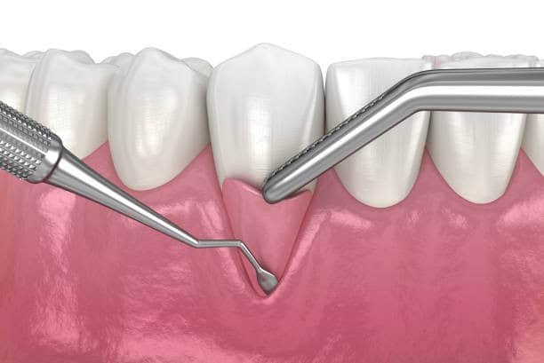 ما لا تعرفه عن جراحة الأسنان وكيفية اختيار الجراح المناسب!