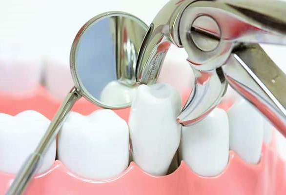 اسباب اللجوء لجراحة الأسنان