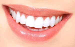 ما هي ابتسامة الفينير؟ ومعلومات عن أفضل مركز طبي لعلاج وتجميل الاسنان