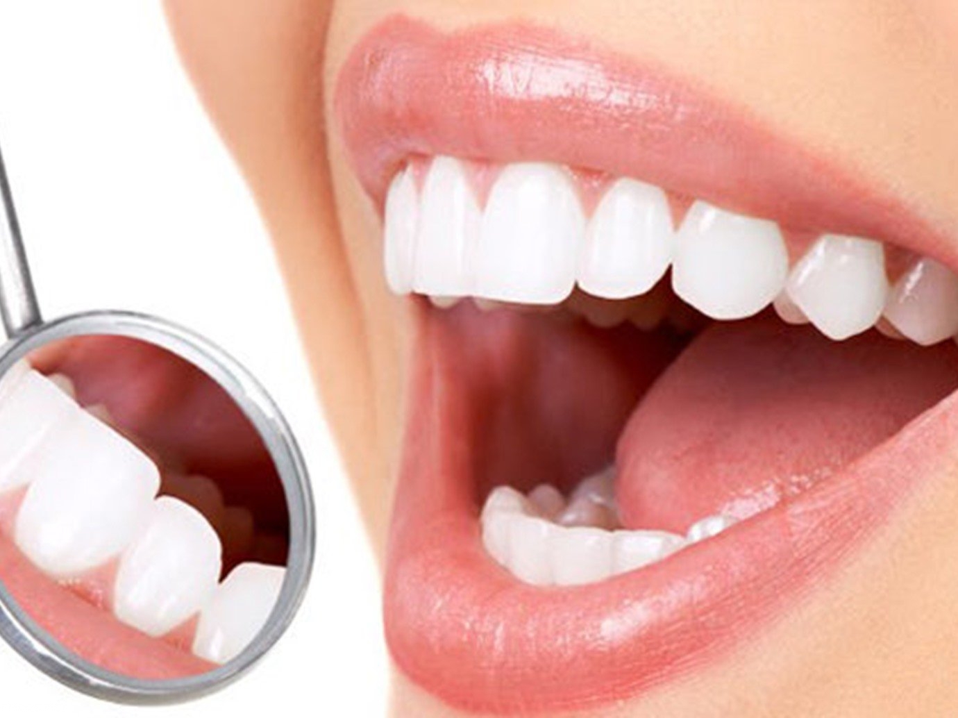 الحالات التي يستخدم فيها عدسات الأسنان اللاصقة
