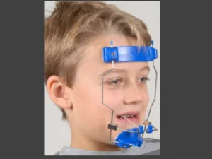 معلومات عن جهاز تعديل الفك السفلي للاطفال وفترة التعافي بعد العملية