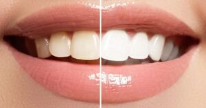 ما افضل عيادة اسنان ابتسامة هوليود؟ والتقنيات الحديثة التي تتبعها!