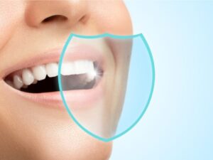 تعرف على شكل حشو الأسنان الأمامية وكم سعره في المركز الطبي لرعاية الأسنان؟