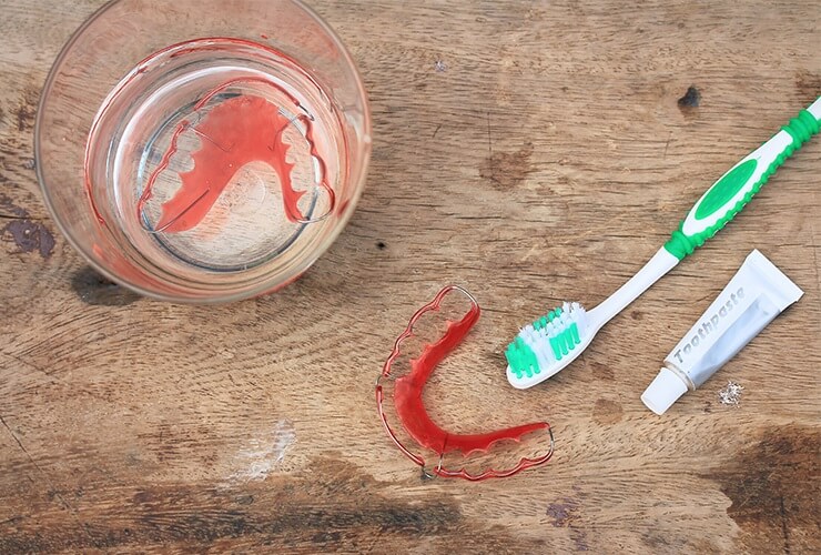 طريقة تنظيف مثبت الأسنان