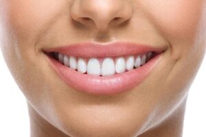 كيفية تجميل الاسنان وكم سعره في المركز الطبي لرعاية الأسنان؟