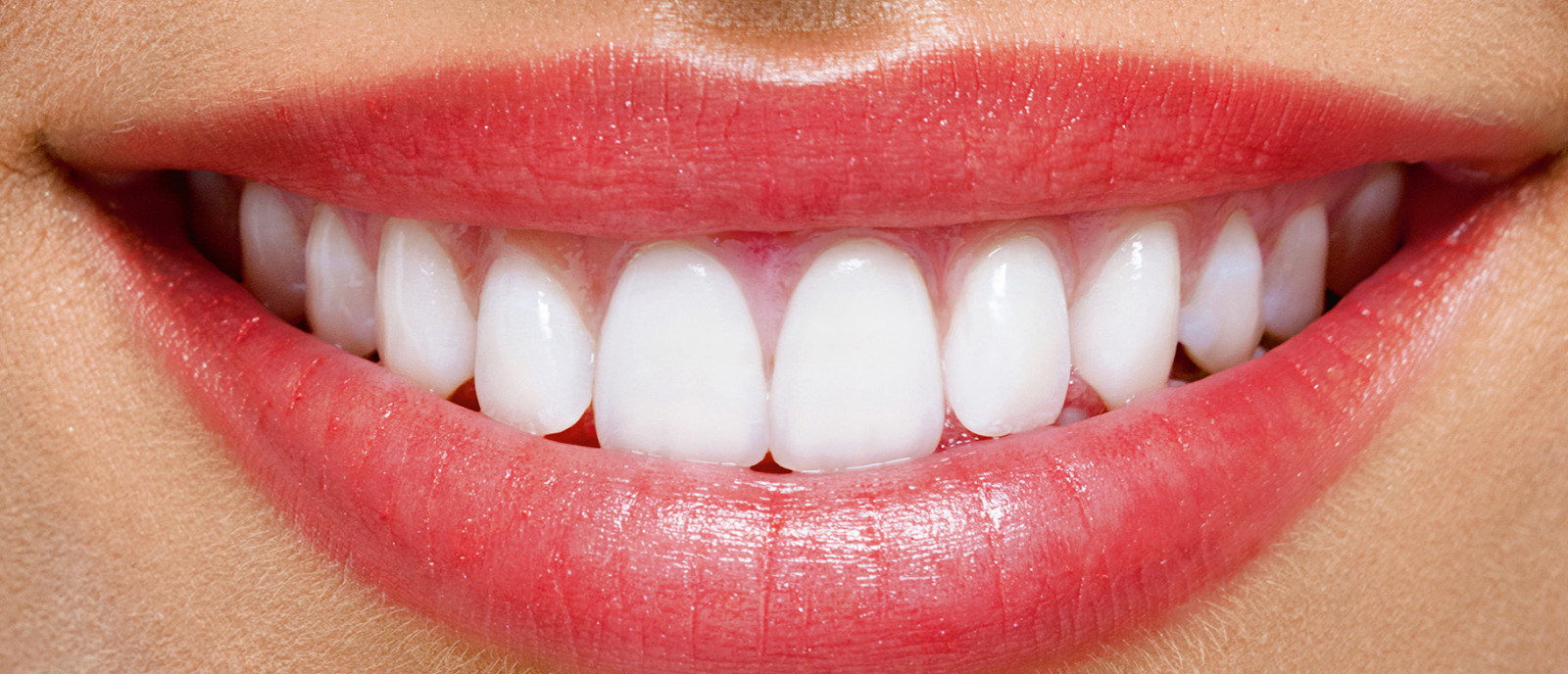 معلومات مهمة عن تكلفة hollywood smile والفرق بينها وبين تبييض الأسنان!
