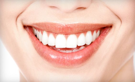 فوائد عدسات الاسنان