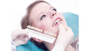ما هي طريقة ازالة عدسات الاسنان؟ وما هو أفضل مركز طبي للقيام بذلك؟