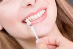 اكتشف خطوات تركيب عدسات اسنان شفافه وكيفية المحافظة عليها؟
