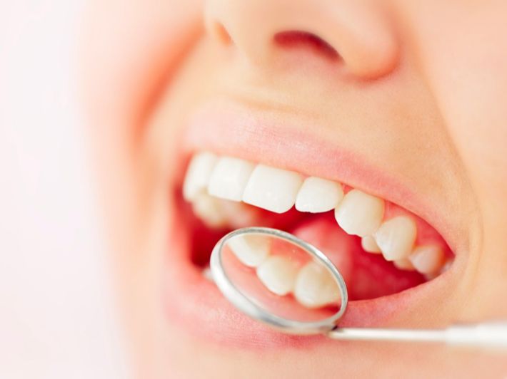 الحالات المستبعدة من تبييض حشوات الاسنان