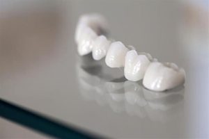 معلومات عن تركيب اسنان للاطفال وما هي الطريقة المُستخدمة؟