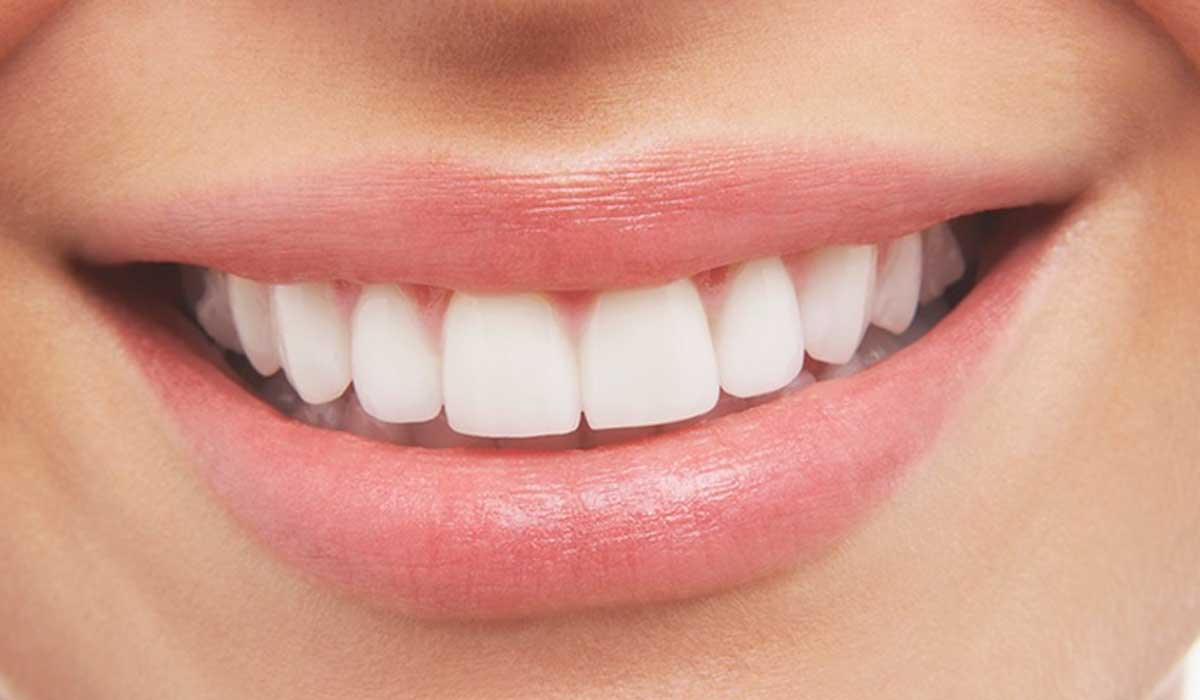 أهمية حشو الأسنان الأمامية