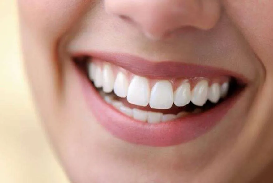 ما هي أنواع الحشوات التجميلية لسد الفراغات بين الأسنان؟