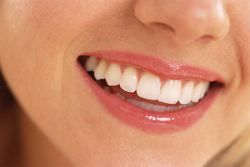 ما هي مميزات الحشوات التجميلية لسد الفراغات بين الأسنان؟