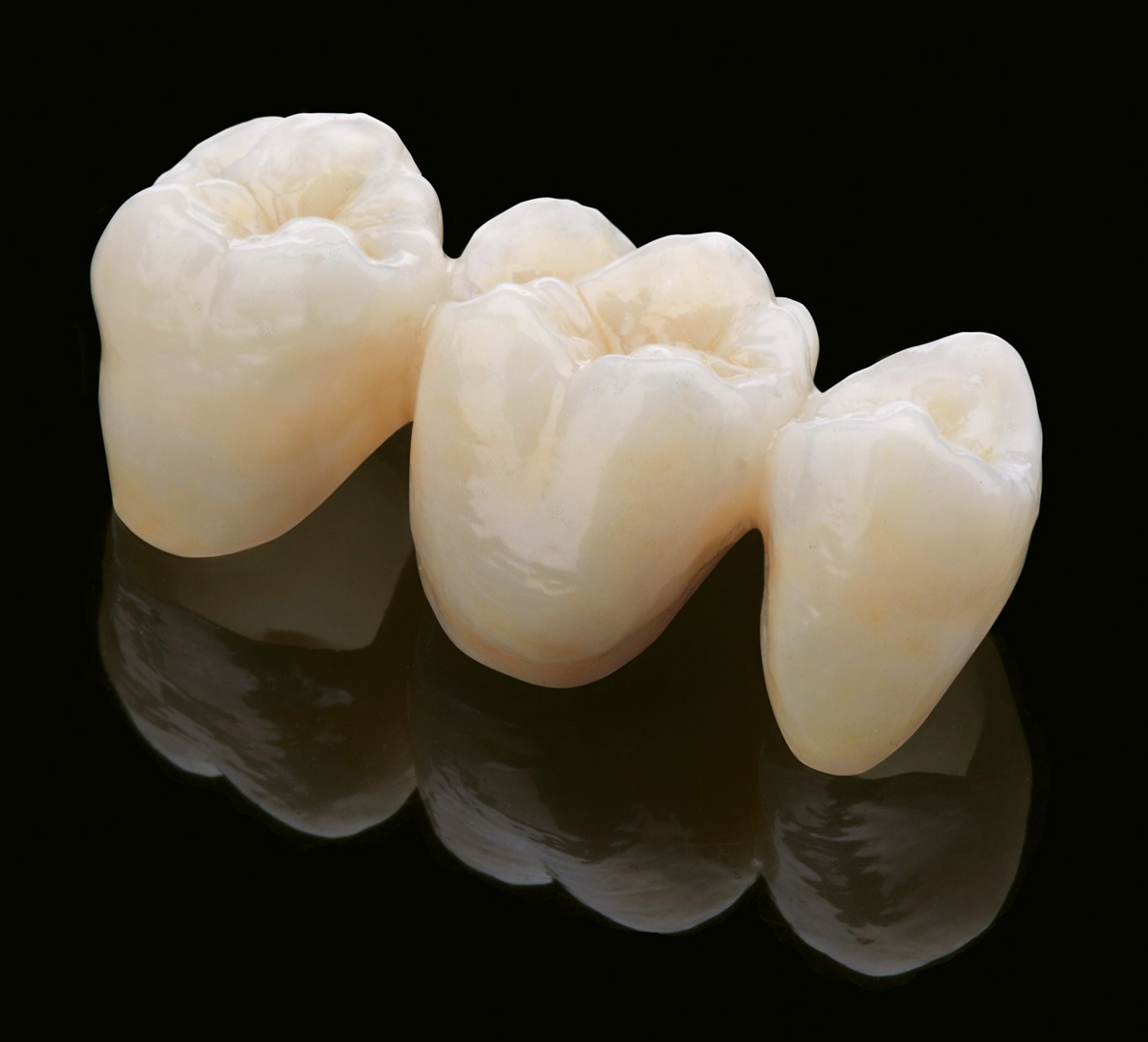 متى نلجأ تركيب الكراون للاسنان