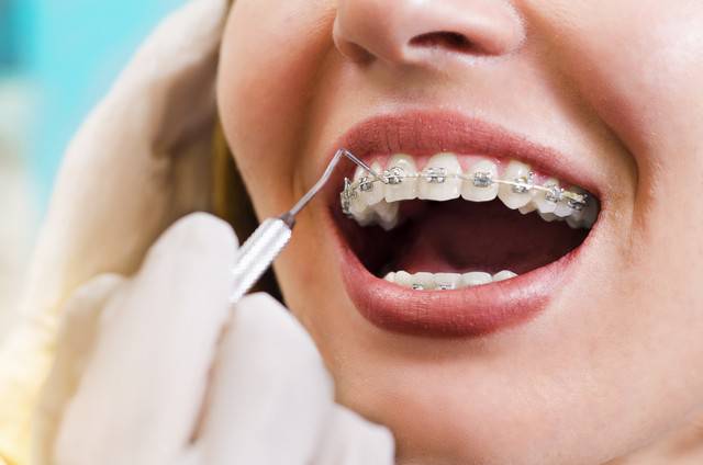 هل زراعة الأسنان مؤلمة؟