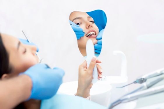 أنواع تبييض الأسنان