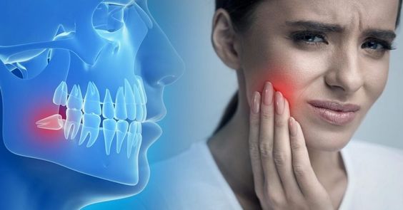 مخاطر زراعة الأسنان بعد الخلع مباشرة