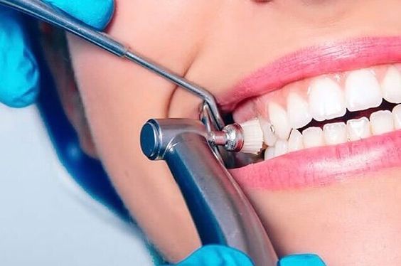 اسعار تبييض الاسنان في مصر
