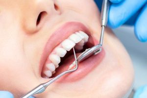 دكتور زرع اسنان وكم تبلغ تكلفة زراعة الاسنان؟