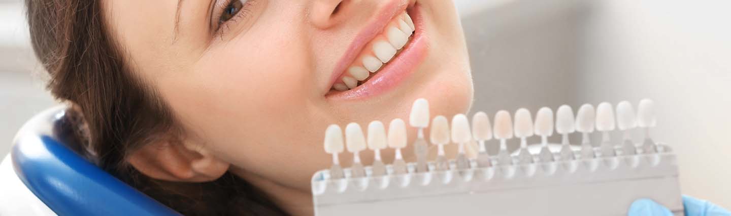 استخدامات فينير الأسنان