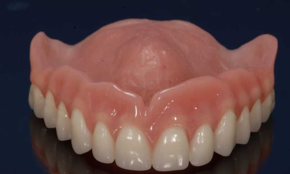 انواع تركيبات بدلة اسنان