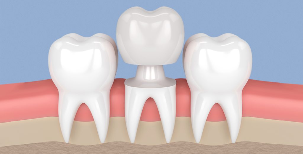 أفضل مركز لعلاج وتجميل الأسنان