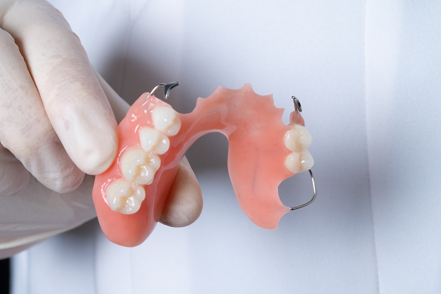 تركيب طقم اسنان جزئي متحرك