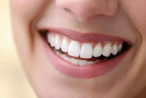 أهم المعلومات عن حشوة تجميلية للفراغات وهل من الممكن سدها دون تقويم أسنان؟