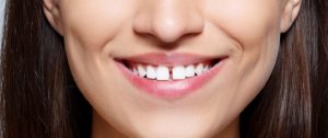 تعرف على طرق سد الفراغات بين الاسنان بالحشو وما هي مميزاتها؟